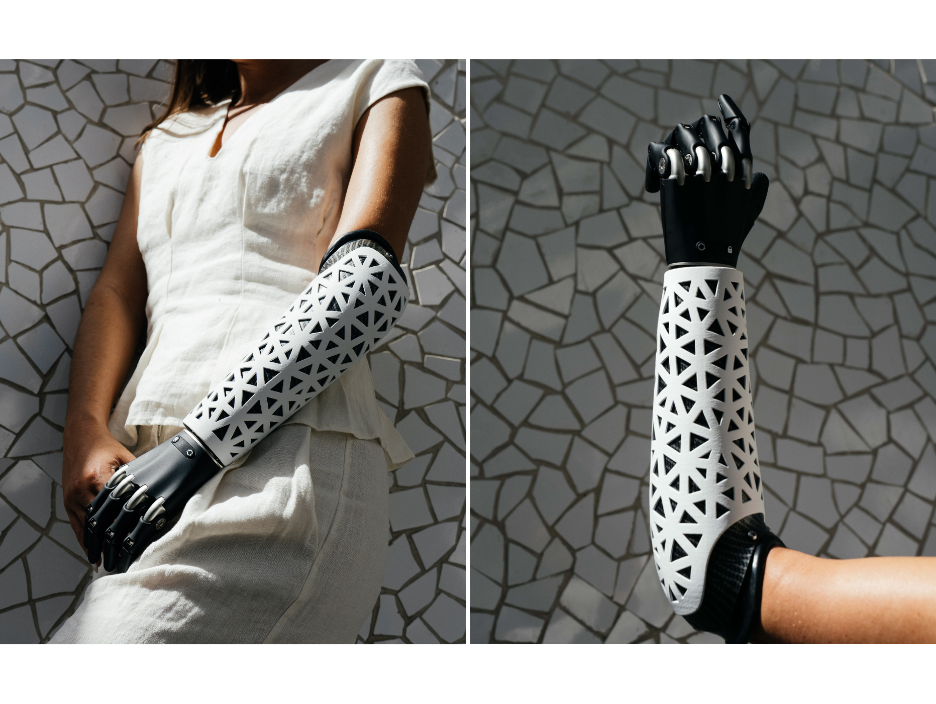 Person standing against a mosaic tile wall, wearing a white sleeveless top and a black arm prosthesis that is decorated with a white geometric patterned cover.
